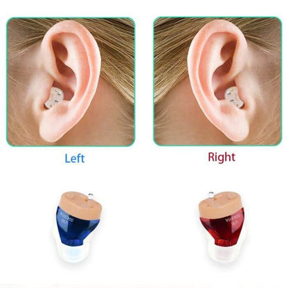 Rechargeable Hearing Aids with Auto Volume Adjustment | Comfortable & Eco-Friendly Hearing Solution 5