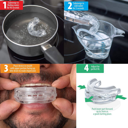 Silent Sleep | Mouth Guard for Snoring with Adjustable Fit | Enhance Sleep Quality for Restful Nights 4