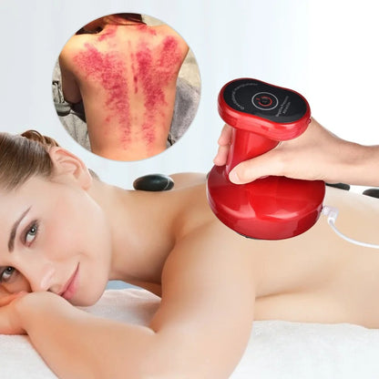 Wellness Tool | Anti-Cellulite Electric Suction Cup with USB Charging | Ergonomic Design for Smooth Skin and Relaxation 7
